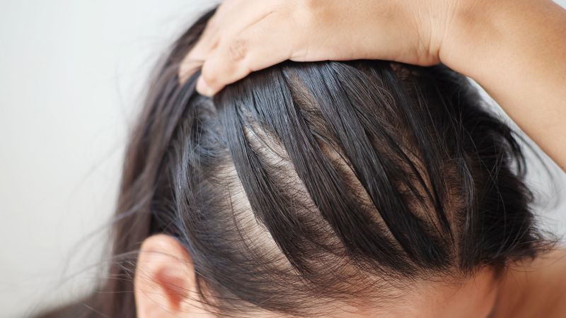 10 clever hair hacks to cover up a thinning hairline  Insert Name Here